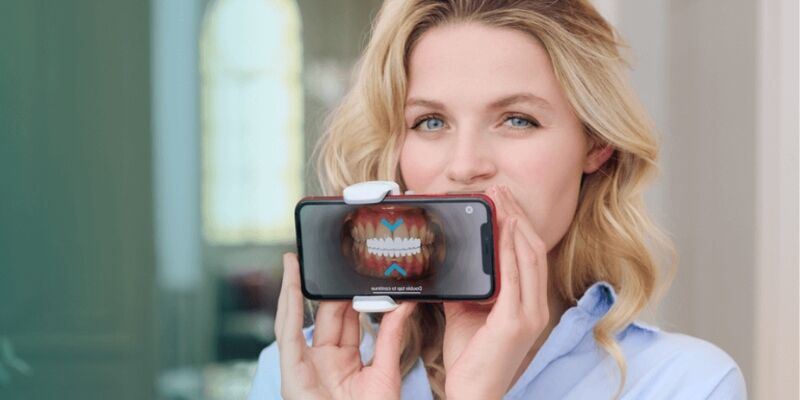 Dental Monitoring